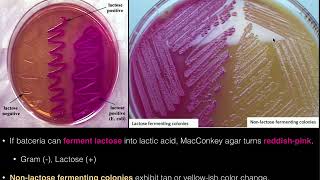 MacConkey Agar [upl. by Boles]