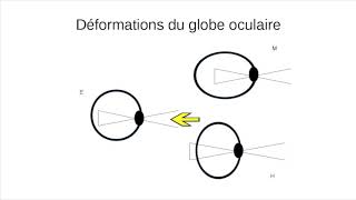 Conférence Ouvrons les yeux la Vue est en Mouvement 2 Bates [upl. by Archle307]