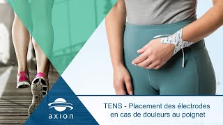 TENS  Placement des électrodes en cas de douleurs au poignet [upl. by Ecnatsnoc]