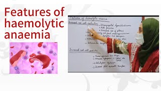 Features of haemolytic anaemia [upl. by Moran375]