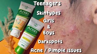 Facewash for acne  Acnes facewash review  pimple solution face wash Acne treatment [upl. by Drawets]