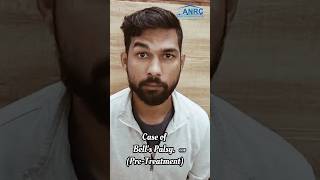 Bells Palsy Treatment with Innovative Exercises at Dehradun India bellspalsy [upl. by Alexio]