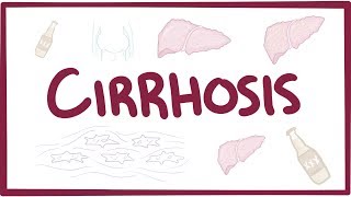 Cirrhosis  causes symptoms diagnosis treatment pathology [upl. by Oramug]