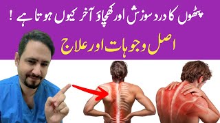 Myalgia Muscle Pain Treatment In Urdu Hindi  Dr Irfan Azeem [upl. by Crudden]