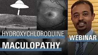 An Objective Method of Diagnosing Hydroxychloroquine Maculopathy [upl. by Ellehcyt821]