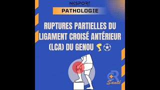 Rupture Partielle du LCA  Comprendre Diagnostiquer et Traiter LCA Kinésithérapie [upl. by Iot624]