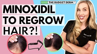 Minoxidil For Hair Loss  Everything you need to know [upl. by Weinrich556]