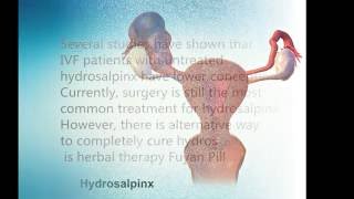 how to cure hydrosalpinx without surgery [upl. by Ahsinra]