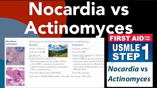 Nocardia vs Actinomyces in HindiUrdu by first aid for USMLE step 1 [upl. by Alver301]