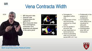 Vena Contracta for Mitral Regurgitation  How I do it series [upl. by Korns]