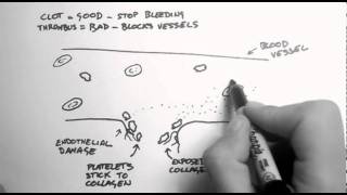 Haemostasis 1  Clots Thrombi amp Antiplatelets [upl. by Bettye]