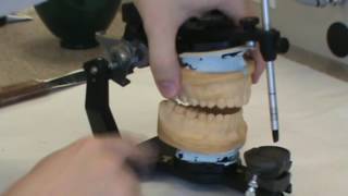 12 How to make and mount Diagnostic Casts  Mounting Mandibular Cast on Hanau Aticulator [upl. by Anar]