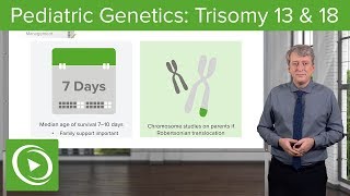 Trisomy 13 amp 18 – Pediatric Genetics  Lecturio [upl. by Shaffer]