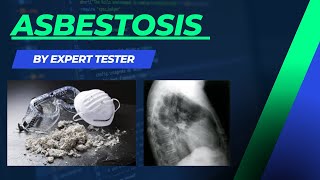 Asbestosis  Pneumoconiosis  Causes  Symptoms  Diagnosis  Treatment amp Pathology [upl. by Oaht]