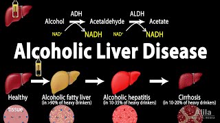 Alcoholic Liver Disease Animation [upl. by Milford]