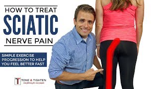 How To Treat Sciatica  Effective Home Exercise Progression For Sciatic Nerve Pain [upl. by Schach181]