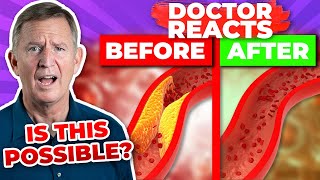 CAN SUPPLEMENTS CLEAN YOUR ARTERIES  Doctor Reacts [upl. by Neenaej]