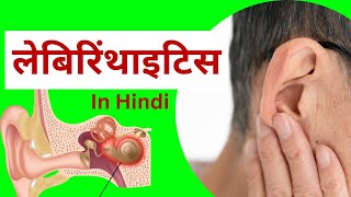 लैबिरिंथाइटिस  कारण लक्षण प्रबंधन  nursing notes in hindi  labyrinthitis in hindi [upl. by Lrae]