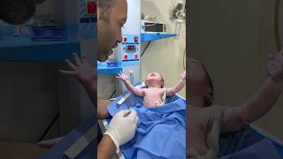 moro reflex for examination of neonatal nervous system cute [upl. by Jeno638]