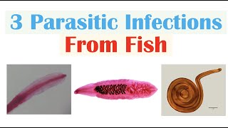 3 Parasitic Infections From Fish Diphyllobothriasis Clonorchiasis Anisakiasis [upl. by Rhetta]