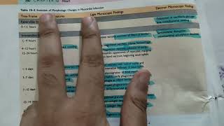 myocardial infarction morphology easy explanation  cardiovascular pathology [upl. by Repohtsirhc]