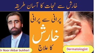 KHARISH KA ILAJ  Scabies Treatment In Urdu  Kharish Khatam Karne Ka Tarika [upl. by Byron]