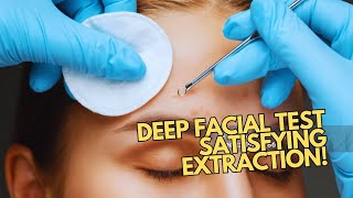 Satisfying Deep Facial Extraction Moments  Professional Review  Skin Extraction  Pores Cleaning [upl. by Calista]