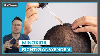 Minoxidil bei Haarausfall Die RICHTIGE Dosierung Nebenwirkungen amp Kosten [upl. by Bartholomeus121]