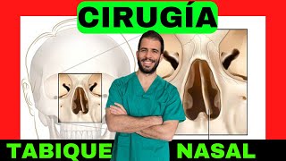 ✅ ¿Tienes el Tabique nasal desviado Operación de SEPTOPLASTIA 👃 Síntomas y tratamiento [upl. by Eerej852]