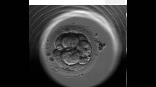 ES  continual monitoring of embryo development in Embryoscope [upl. by Carothers]