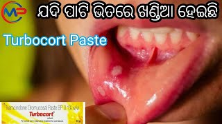 Turbocort Paste Triamcinolone Olomucosal Paste Mouth Ulcer Gel Review In Odia [upl. by Isayg]