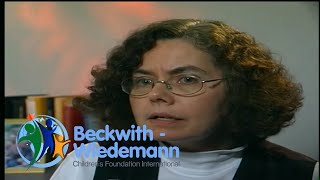 Speech and Feeding Issues In BeckwithWiedemann Children [upl. by Jenda]