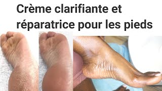 COMMENT ECLAIRCIRCIR ET COMBATTRE LES PIEDS SECS [upl. by Ahsilrac681]