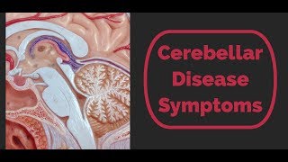 Cerebellar Disease Symptoms [upl. by Erdnael103]