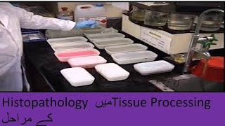 tissue processing in histopathology lab [upl. by Hart224]