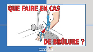 Que faire en cas de brûlure [upl. by Otrebliw]