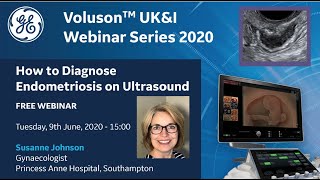 How to diagnose Endometriosis  GE WEBINAR 62020 [upl. by Erapsag]