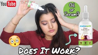 New Onion Scalp Serum OIL or SERUM Does It Work [upl. by Llenad97]