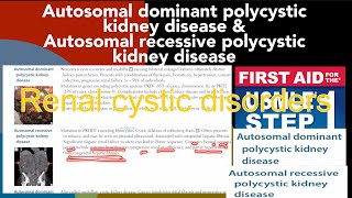 Autosomal dominant polycystic kidney disease amp Autosomal recessive polycystic kidney disease [upl. by Cirdnek]