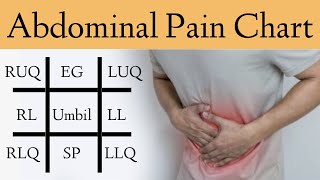 Abdominal Pain Causes by Location and Quadrant Differential Diagnosis Chart [upl. by Maag]