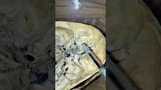 Anterior cranial fossa spotting video easy explanation [upl. by Ailime]