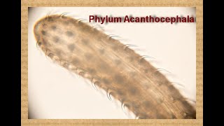 Phylum Acanthocephala quot Thornyheaded worms Dr Manar Elmehankar [upl. by Jerome]