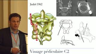 Bases anatomiques des arthrodeses occipito cervicales Pr Hamel Toulouse [upl. by Chivers]