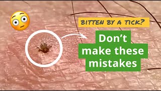 The Top 4 Tick Mistakes You Dont Want to Make [upl. by Oemac]