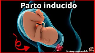 PARTO INDUCIDO  Como Parir  PASO A PASO Contracciones y mas [upl. by Emilie411]