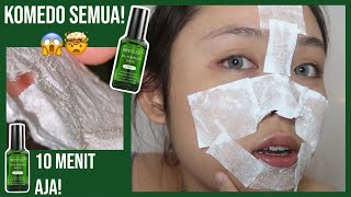 KOMEDO BERSIH 10 MENIT AJA BREYLEE BLACK HEAD MASK [upl. by Lancelle]