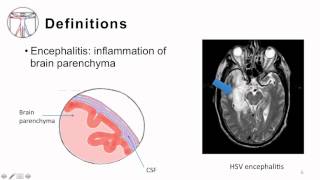 2 Bacterial Meningitis Pathogenesis and Clinical Manifestion [upl. by Illyes914]