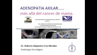 2  12 Adenopatía axilar más allá del cáncer de mama  Dr Cruz [upl. by Ellessig279]