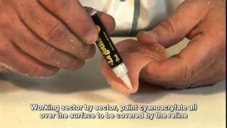 Deflex flexible dentures Video 9 Relines with acrylic [upl. by Arhaz]