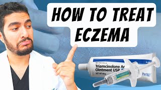 How To Treat Eczema Dermatologist Explains [upl. by Rihat]